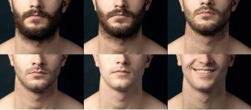 C) 4 SPARTAN BÁLSAMO + GORRA DE REGALO - Crecimiento de Barba y Bigote | Minoxidil 5% (Dosis Óptima) + Biotina + Bergamota | ENVÍO GRATIS